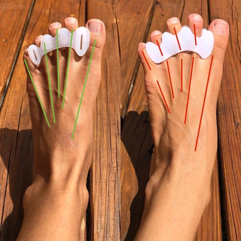 Séparateurs d’Orteils en Silicone - Lot de 2 Correcteurs Hallux Valgus pour Pied Droit et Gauche
